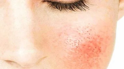 blog-400-225 blog-400-225